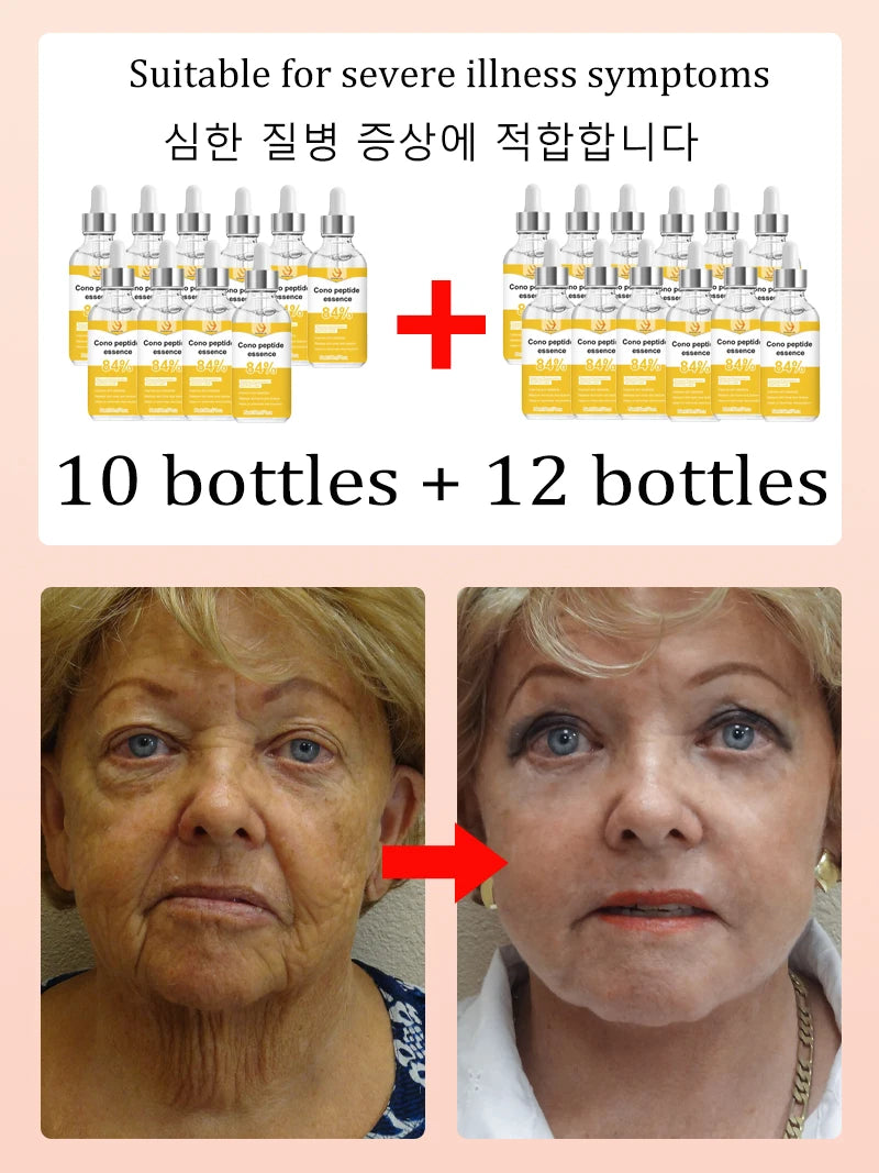 No fine lines ,From wrinkles and does not look old