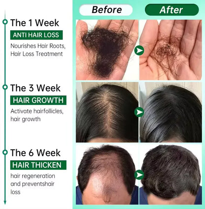 Fast Ginger Hair Growth Spray Roots Grow Anti Hair Loss Hair Regrowth Serum Scalp Damaged Repair Nourish Care Products Women Men