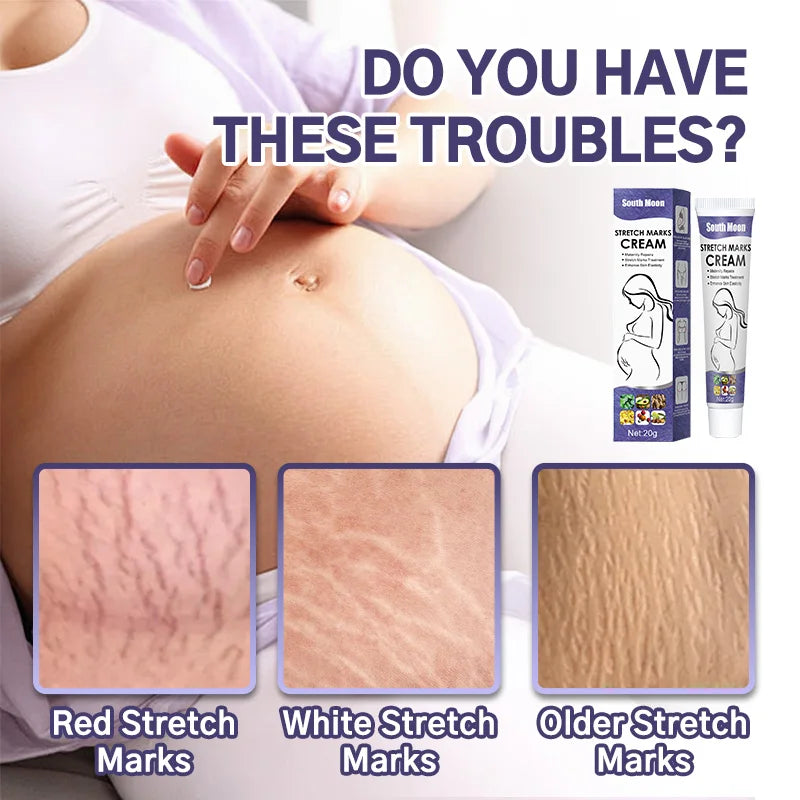 Stretch Mark Repair Cream For Pregnant Women Postpartum Care Firm Light Lines Obesity Lines Growth Lines Repair Cream