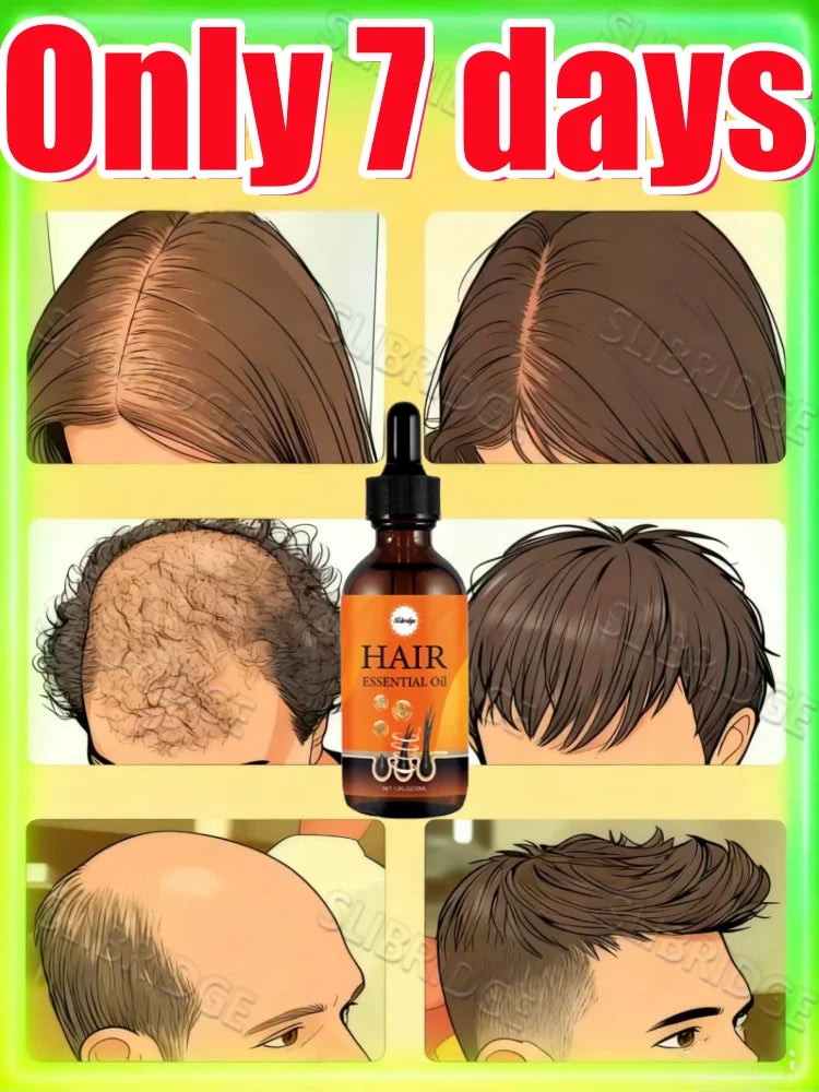 Winter nourishment should not neglect scalp health; regain thick, beautiful hair,free shipping.