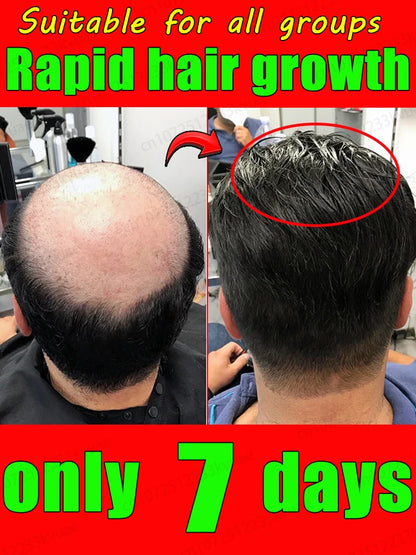 Double hair growth essential oil, the result of plant essence research, say goodbye to baldness and hair loss, without harming t