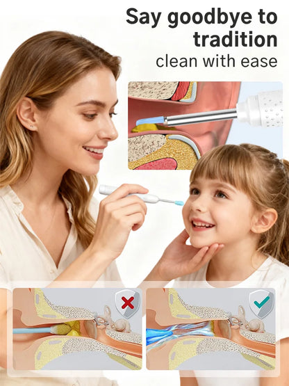 Wireless Visual Ear Cleaner HD Camera LED Light Rechargeable Ear Wax Removal Tool for All Ages