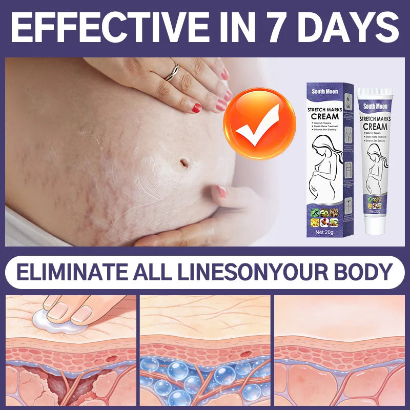 Stretch Mark Repair Cream For Pregnant Women Postpartum Care Firm Light Lines Obesity Lines Growth Lines Repair Cream