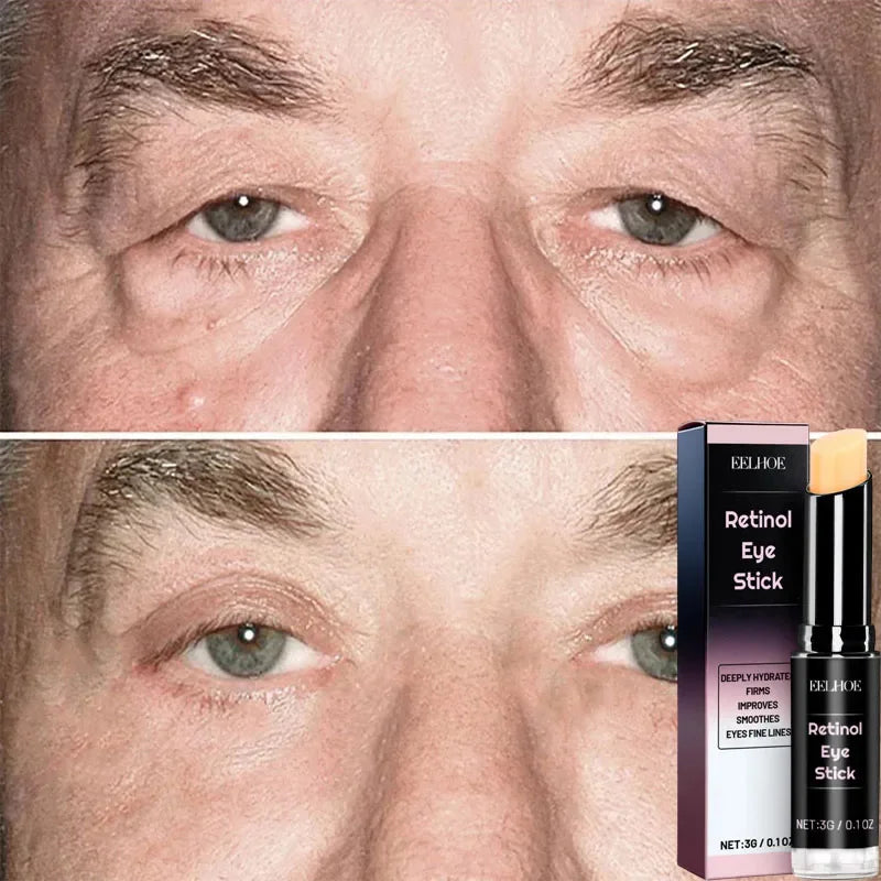 Instant Eye Bag Removal Cream Collagen Anti-Wrinkle Fade Fine Lines Firming Skin Anti Dark Circle Puffiness Brighten Eye Care