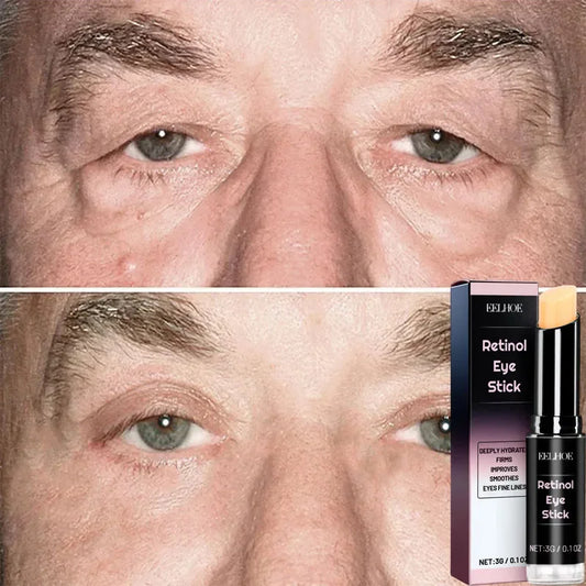 Instant Eye Bag Removal Cream Collagen Anti-Wrinkle Fade Fine Lines Firming Skin Anti Dark Circle Puffiness Brighten Eye Care