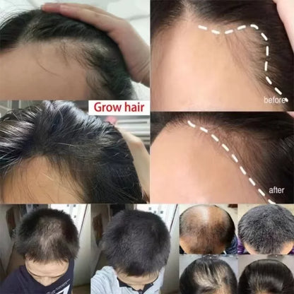 Fast Ginger Hair Growth Spray Roots Grow Anti Hair Loss Hair Regrowth Serum Scalp Damaged Repair Nourish Care Products Women Men