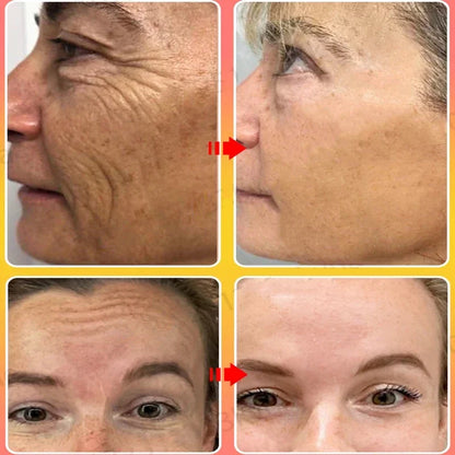 Sakura Whitening Face Cream Wrinkle Remover Fade Fine Lines Serum Firm Lift Shrink Pores Moisturizing Brighten Smooth Skin Care