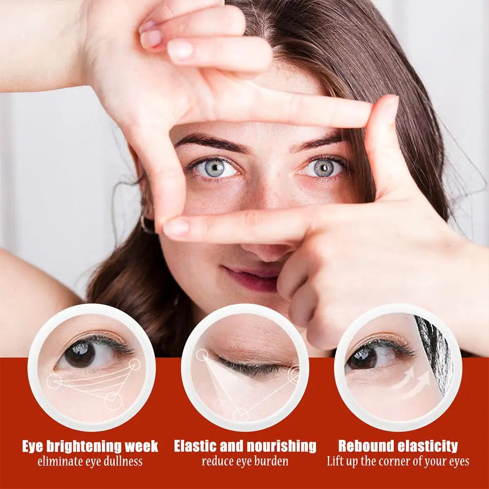 30ml Eye Fat Granules Removal Serum Effective Anti-Particles Eye Cicle Line Fine Fade Improve Serum Care Puffiness Dark F4A5
