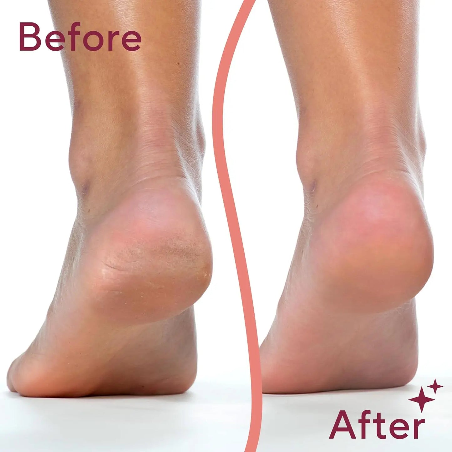 Electric Foot Grinder Automatic Foot Callus Rubbing Pedicure Dead Skin Callus Remover for Foot Rechargeable Foot Beauty Machine