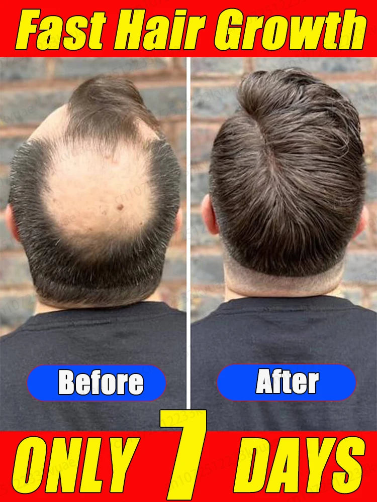 The most effective hair growth product of this century, you can grow the most beautiful hair even when you are 80 years old