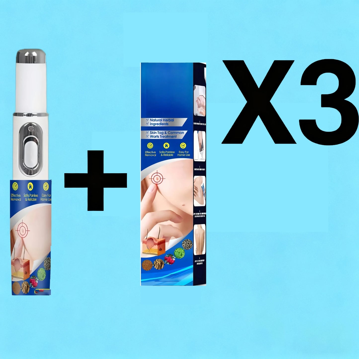 2025 New Upgrade Blue Laser Solve Wart Tool