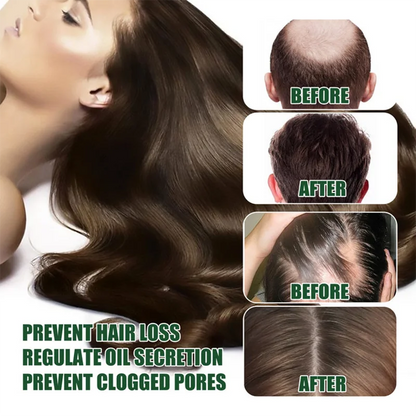 98% of buyers buy again, have more and more hair, say goodbye to baldness, thick hair,Hot selling product