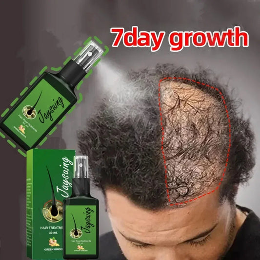 Fast Ginger Hair Growth Spray Roots Grow Anti Hair Loss Hair Regrowth Serum Scalp Damaged Repair Nourish Care Products Women Men