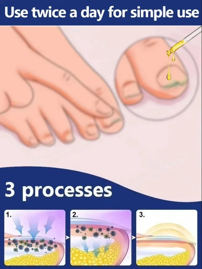 Quickly eliminate fungus and restore healthy nails  9