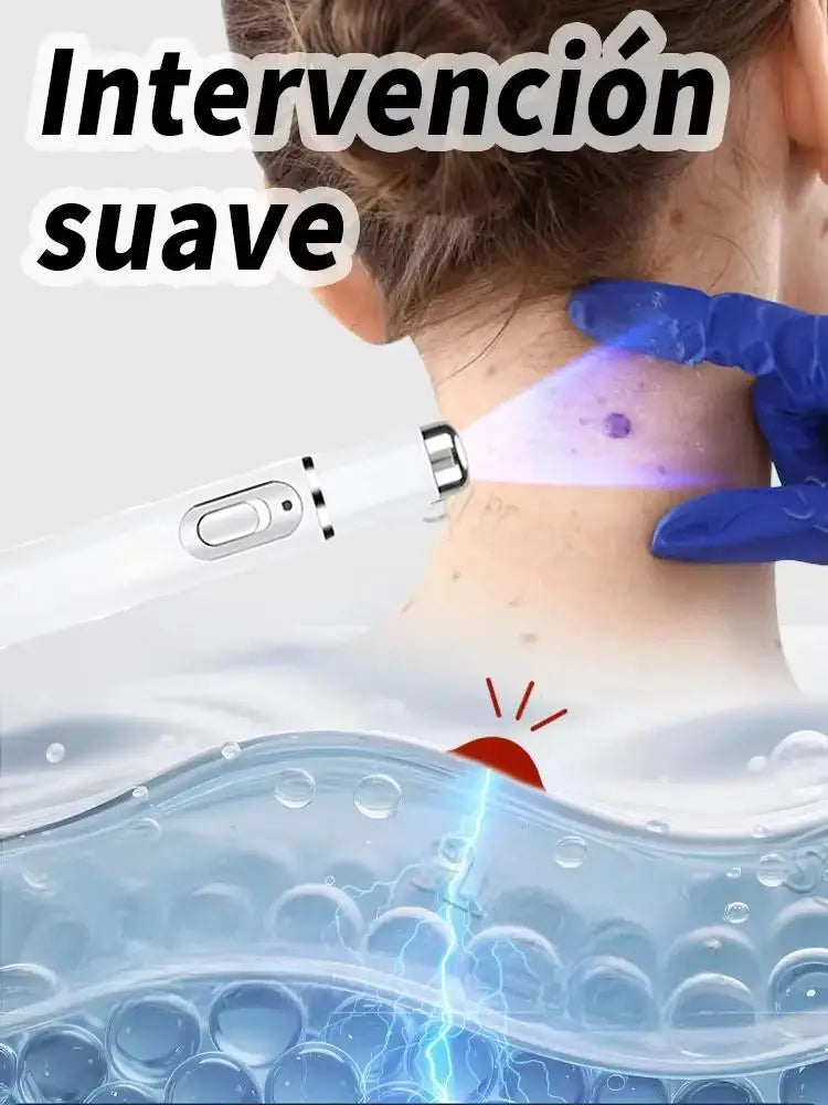 Today's Deal,free shipping,blue light pen solve warts,wart care tools,Bestselling