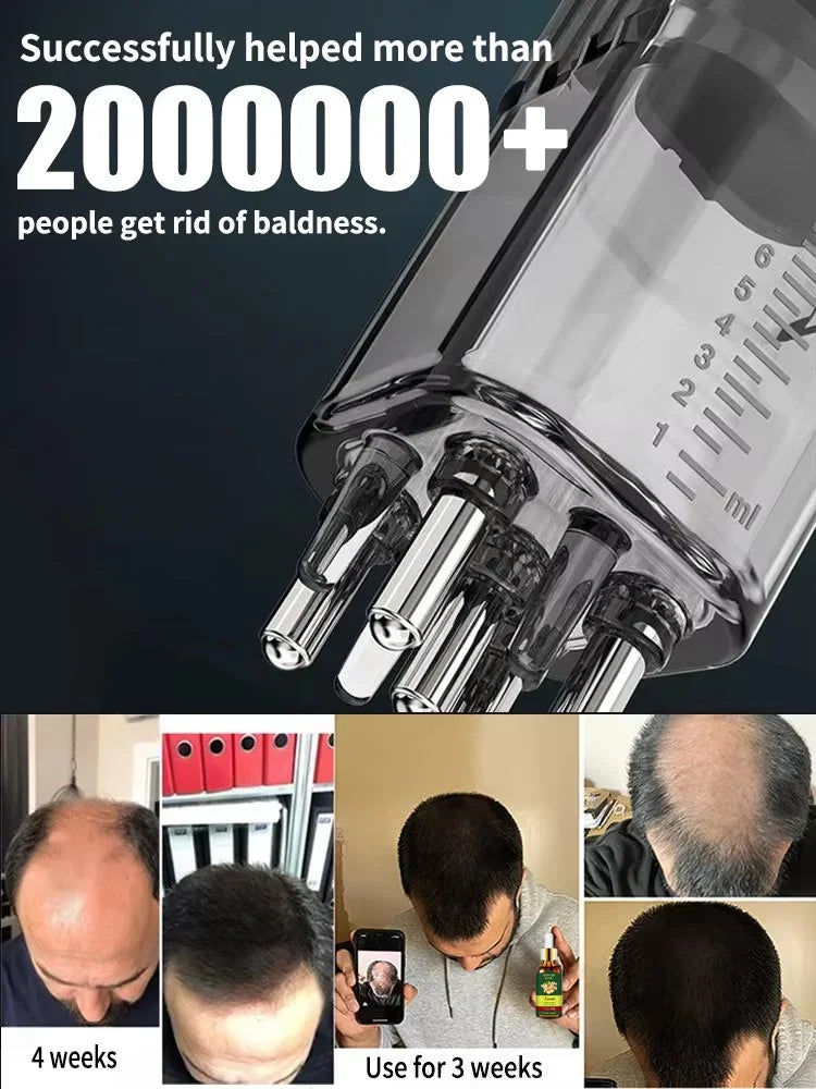 98% of buyers buy again, have more and more hair, say goodbye to baldness, thick hair,Hot selling product