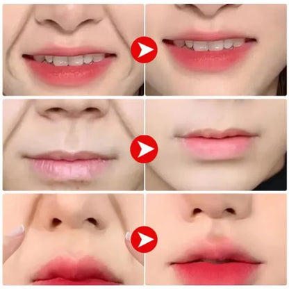 Collagen Nasolabial Folds Patch Contain Hyaluronic Acid  Instant Firming Skin Fade Fine Lines Deep Moisturizing Facial Mask