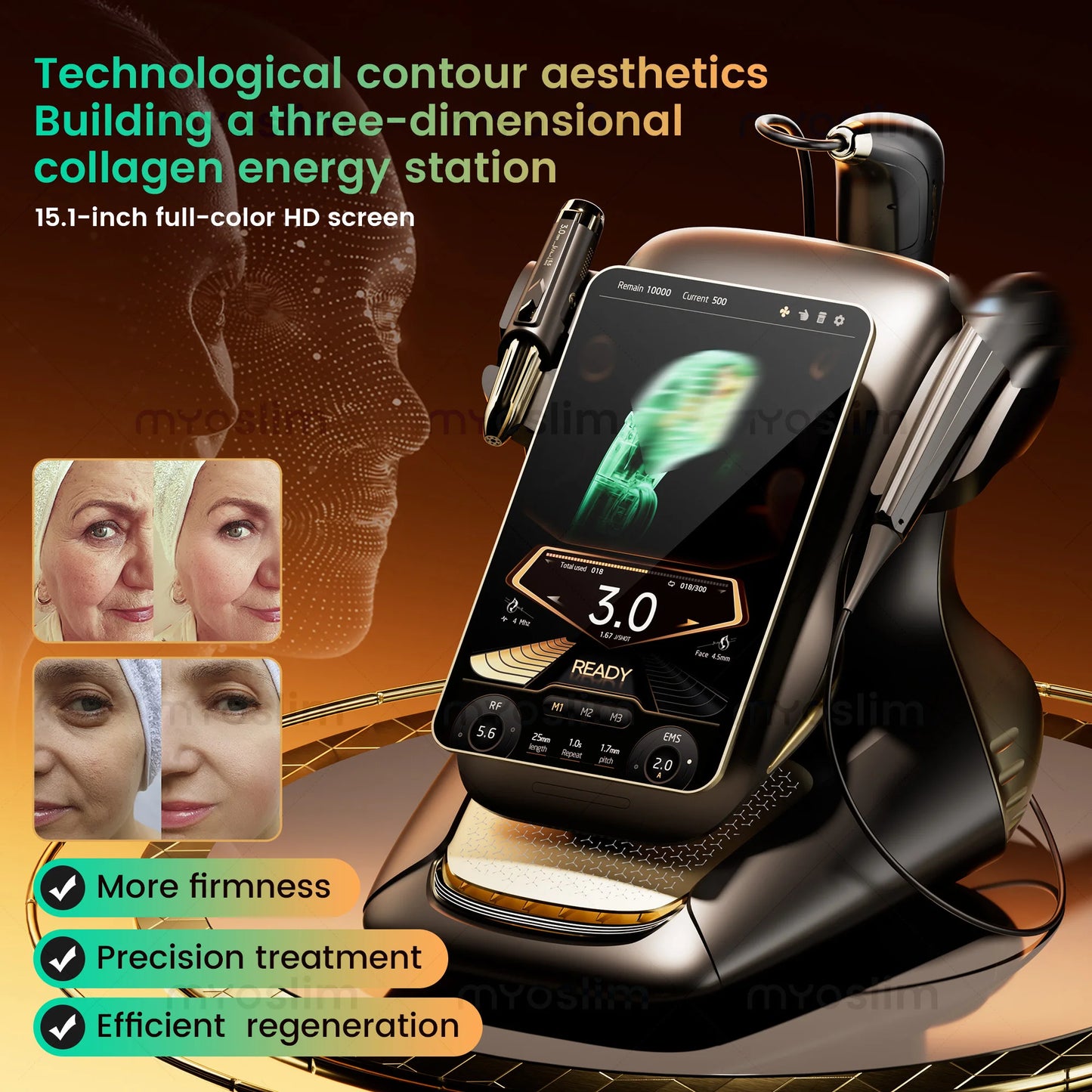 professional beauty Equipment Machine 25D hifu 360MAX for Face Lifting Slimming and Fat Reduction, Latest Model for beauty salon