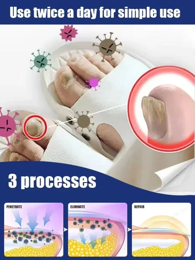 Quickly eliminate fungus and restore healthy nails  9