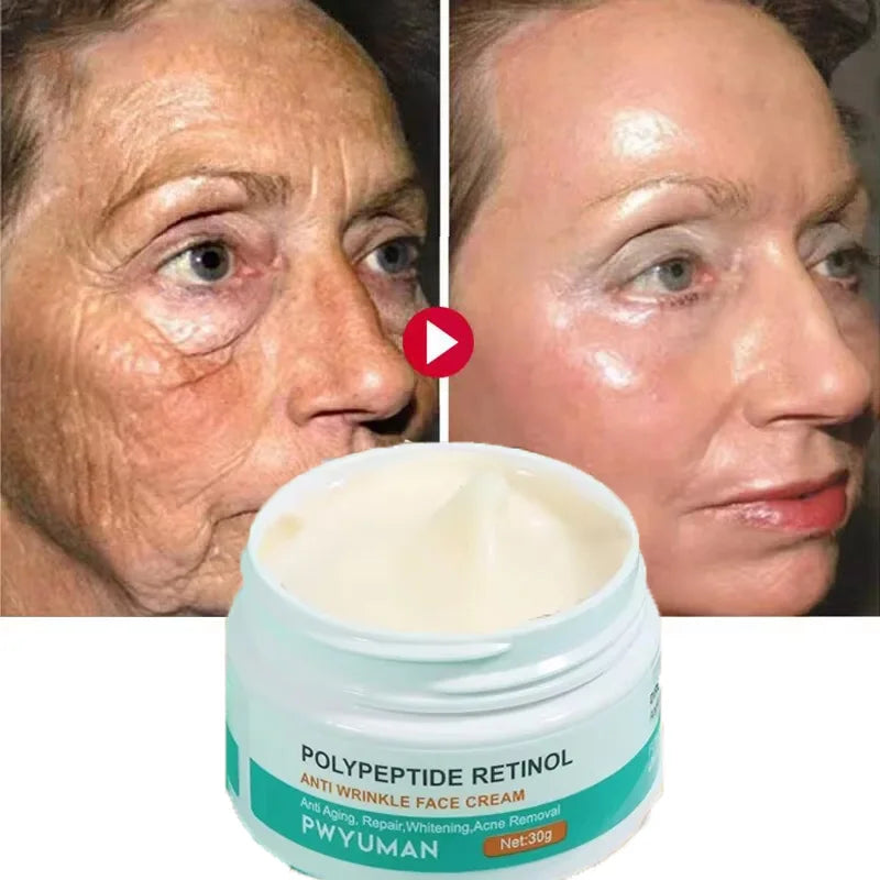 Retinol Wrinkle Remover Face Cream Firming Lifting Anti Aging Fade Fine Lines Moisturizing Whitening Repair Skin Care Cosmetics
