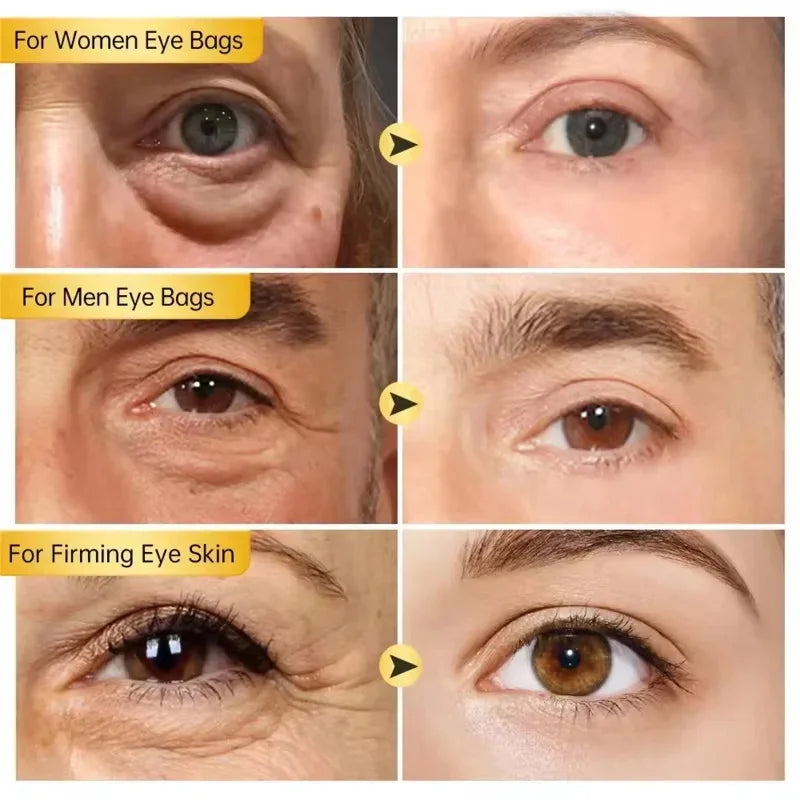 Instant Eye Bag Removal Cream Collagen Anti-Wrinkle Fade Fine Lines Firming Skin Anti Dark Circle Puffiness Brighten Eye Care