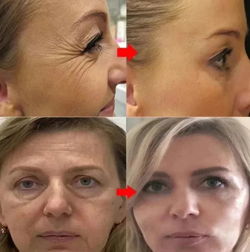Retinol Remove Wrinkle Face Serum Lift Firming Anti Aging Fade Fine Lines Whitening Brightening Moisturizer Skin Care Cosmetics