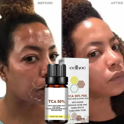 Exfoliating Peeling Oil Facial Scrub Moisturizing Whitening Nourishing Repair Beauty Skin Care Peeling Facial Essence