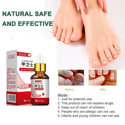 Beauty Health Relaxation Treatment Nail Fungal Treatment Serum Onychomycosis Paronychia Anti Infection Toe Fungus Hand Foot