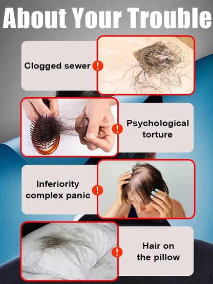 Winter nourishment should not neglect scalp health; regain thick, beautiful hair,free shipping.