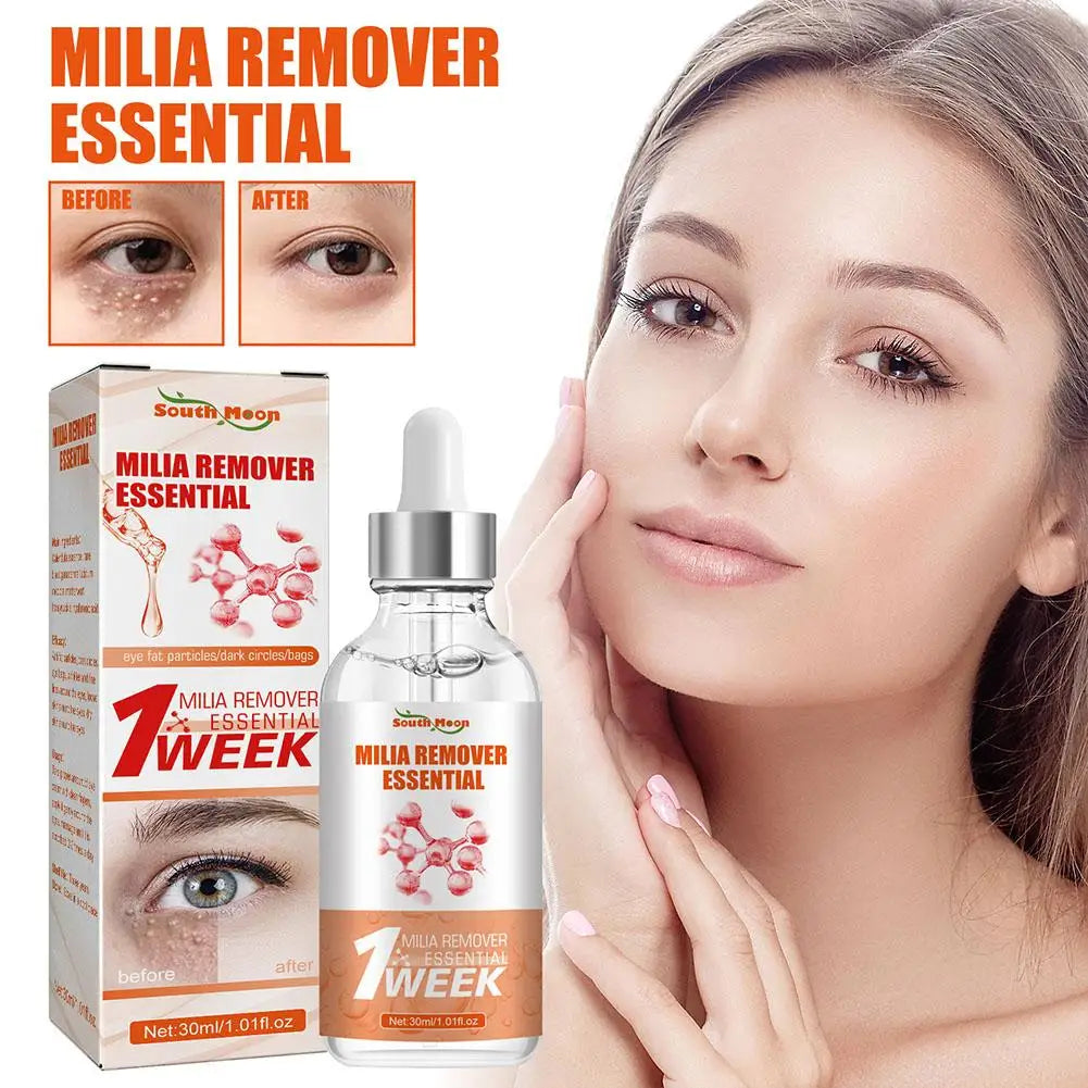 30ml Eye Fat Granules Removal Serum Effective Anti-Particles Eye Cicle Line Fine Fade Improve Serum Care Puffiness Dark F4A5