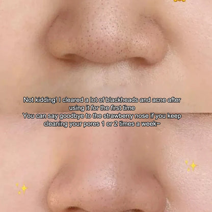 Facial Skin Scrubber Blackhead Remover With Cover Face Spatula Exfoliator Deep Cleansing Skin Care Tool