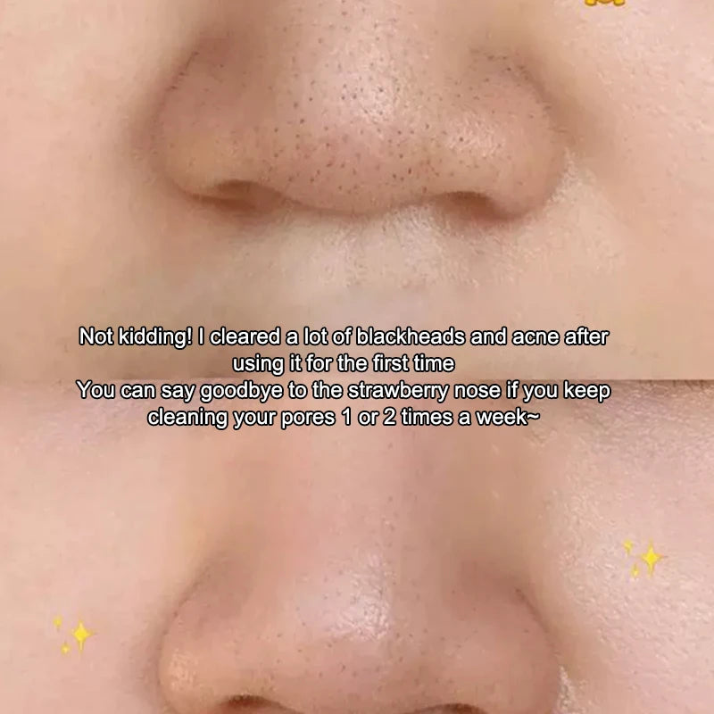 Facial Skin Scrubber Blackhead Remover With Cover Face Spatula Exfoliator Deep Cleansing Skin Care Tool
