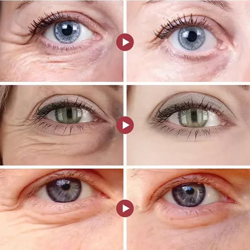 Instant Eye Bag Remove Cream Retinol Anti-Wrinkle Firming Skin Fade Fine Lines Anti Dark Circle Puffiness Brighten Eye SkinCare