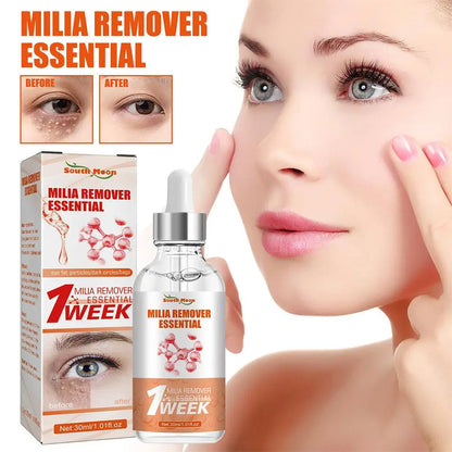 30ml Eye Fat Granules Removal Serum Effective Anti-Particles Eye Cicle Line Fine Fade Improve Serum Care Puffiness Dark F4A5