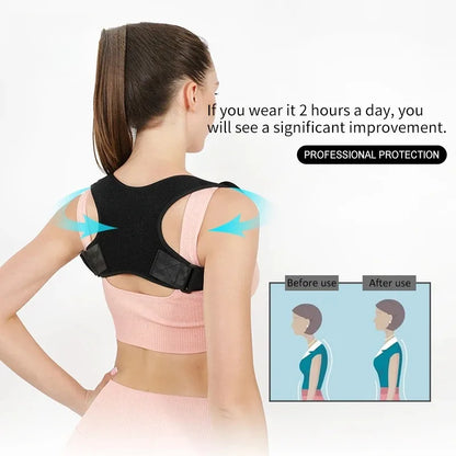 Unisex Adjustable Back Posture Corrector Support Brace for Men And Women Clavicle Spine Shoulder Correction Belt Strap