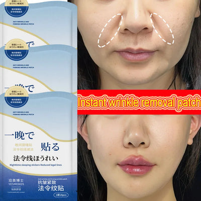 Collagen Nasolabial Folds Patch Contain Hyaluronic Acid  Instant Firming Skin Fade Fine Lines Deep Moisturizing Facial Mask