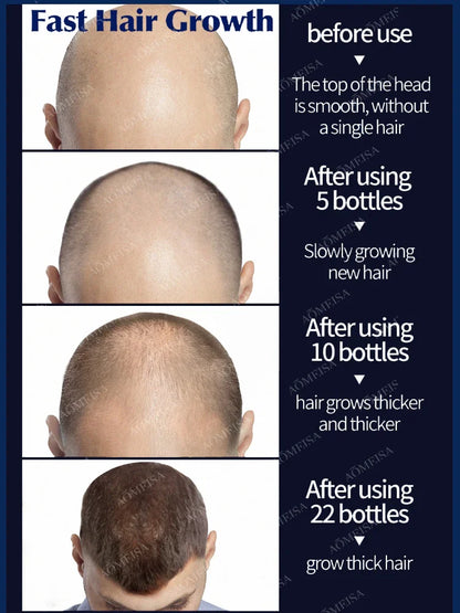 The most effective hair growth product of this century, you can grow the most beautiful hair even when you are 80 years old