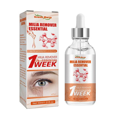 30ml Eye Fat Granules Removal Serum Effective Anti-Particles Eye Cicle Line Fine Fade Improve Serum Care Puffiness Dark F4A5