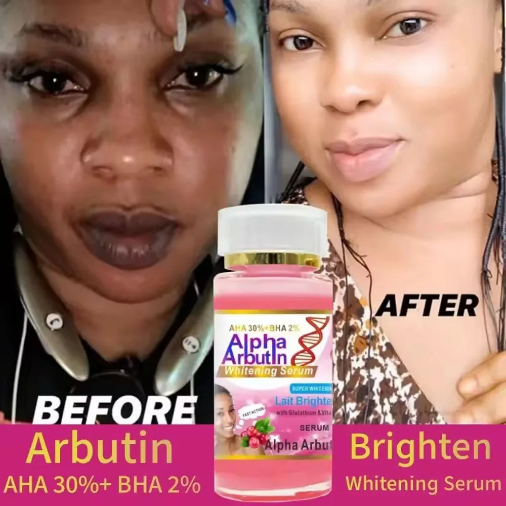 AHA 30%+BHA2% Face Smooth Brightening Moisturizing Improving Dullness Dark Skin Beauty Care Cream
