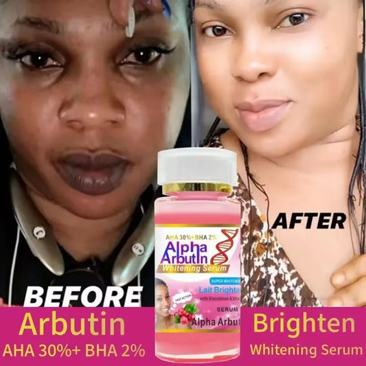 AHA 30%+BHA2% Face Smooth Brightening Moisturizing Improving Dullness Dark Skin Beauty Care Cream