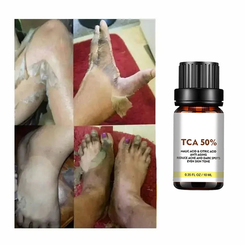 Exfoliating Peeling Oil Facial Scrub Moisturizing Whitening Nourishing Repair Beauty Skin Care Peeling Facial Essence