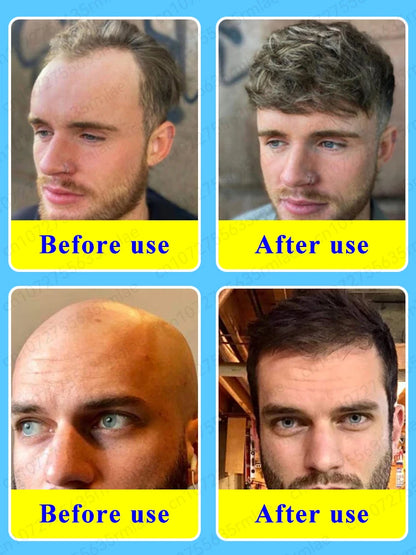 The most effective hair growth product of this century, you can grow the most beautiful hair even when you are 80 years old