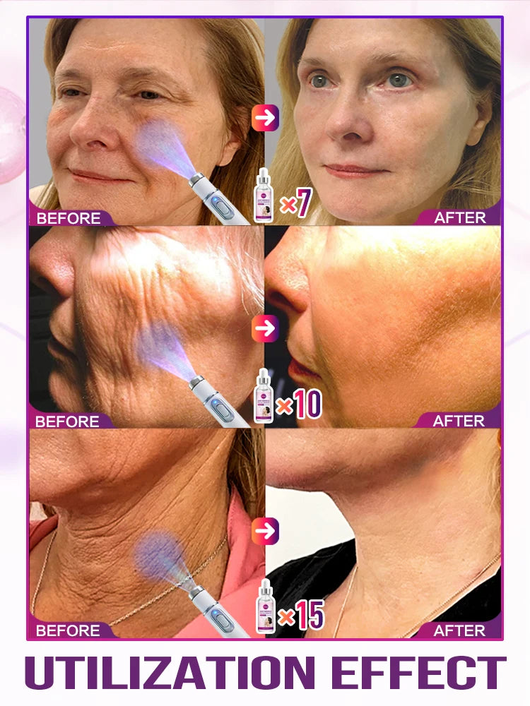 Self-rejuvenation from now on, youthful beauty, anti-aging, firming skin