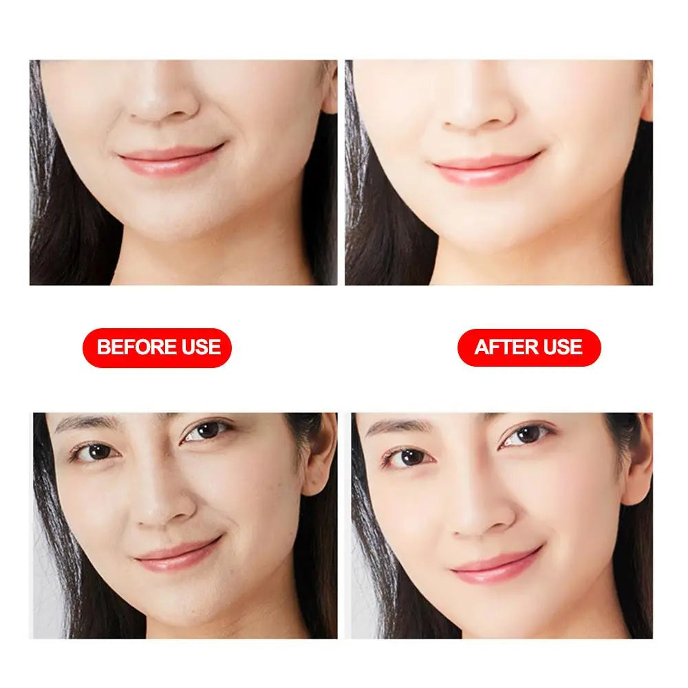Wrinkle Remover Patches Hyaluronic Acid Microcrystalline Patch Lifting Sticker Nutriti Wrinkle Face Lift Decree Eye Removal I3n6