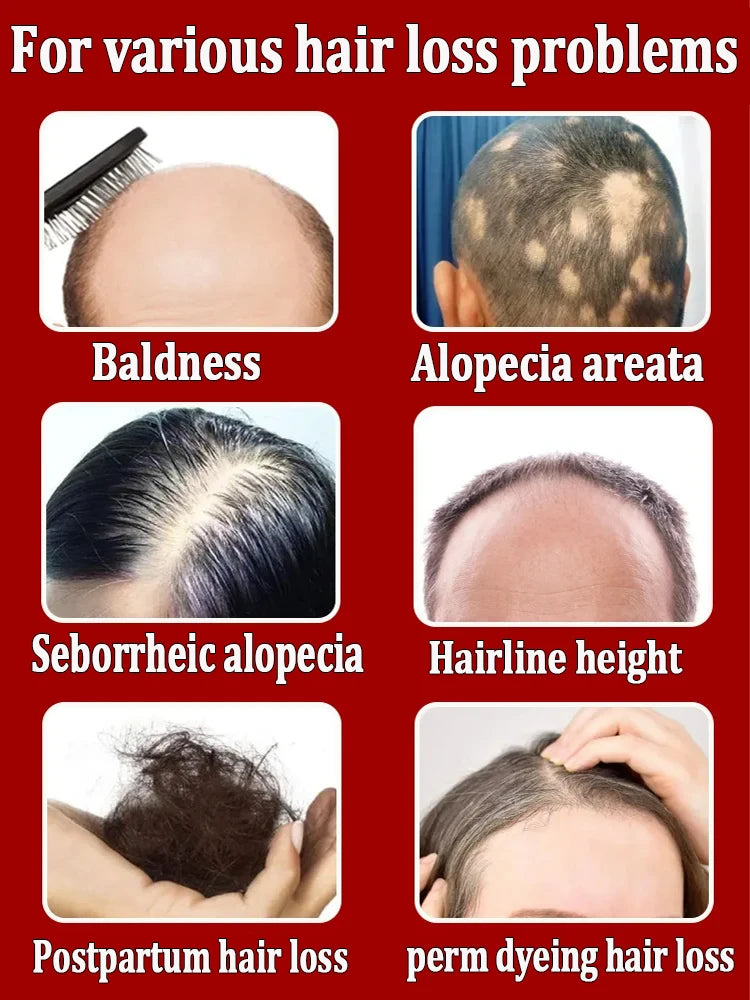 Double hair growth essential oil, the result of plant essence research, say goodbye to baldness and hair loss, without harming t