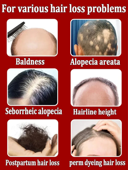 Double hair growth essential oil, the result of plant essence research, say goodbye to baldness and hair loss, without harming t