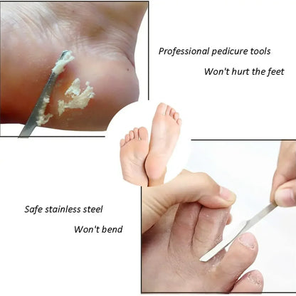 1/10pc Foot Callus Remover Stainless Steel Pedicure Exfoliating Scraper for Dead Skin&Calluses Foot Care Tool Beauty Accessories