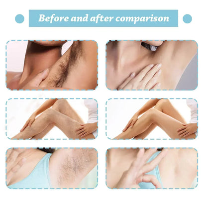 Permanent Hair Inhibition Serum Painless Allantoin Lupine Essence Hair Remover Hair Growth Inhibitor Depilatory Body Cream Care
