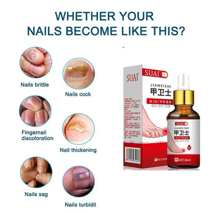 Beauty Health Relaxation Treatment Nail Fungal Treatment Serum Onychomycosis Paronychia Anti Infection Toe Fungus Hand Foot