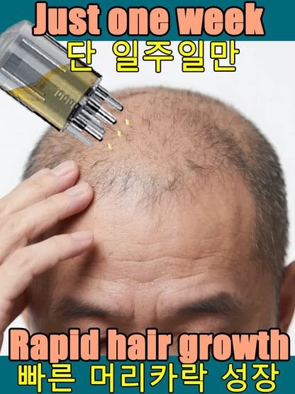 98% of buyers buy again, have more and more hair, say goodbye to baldness, thick hair,Hot selling product